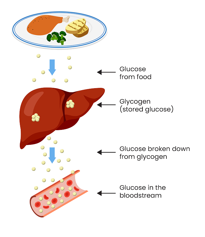 Image showing the typical metabolic process the body takes to turn glycogen into glucose and what the process looks like with GSDIa